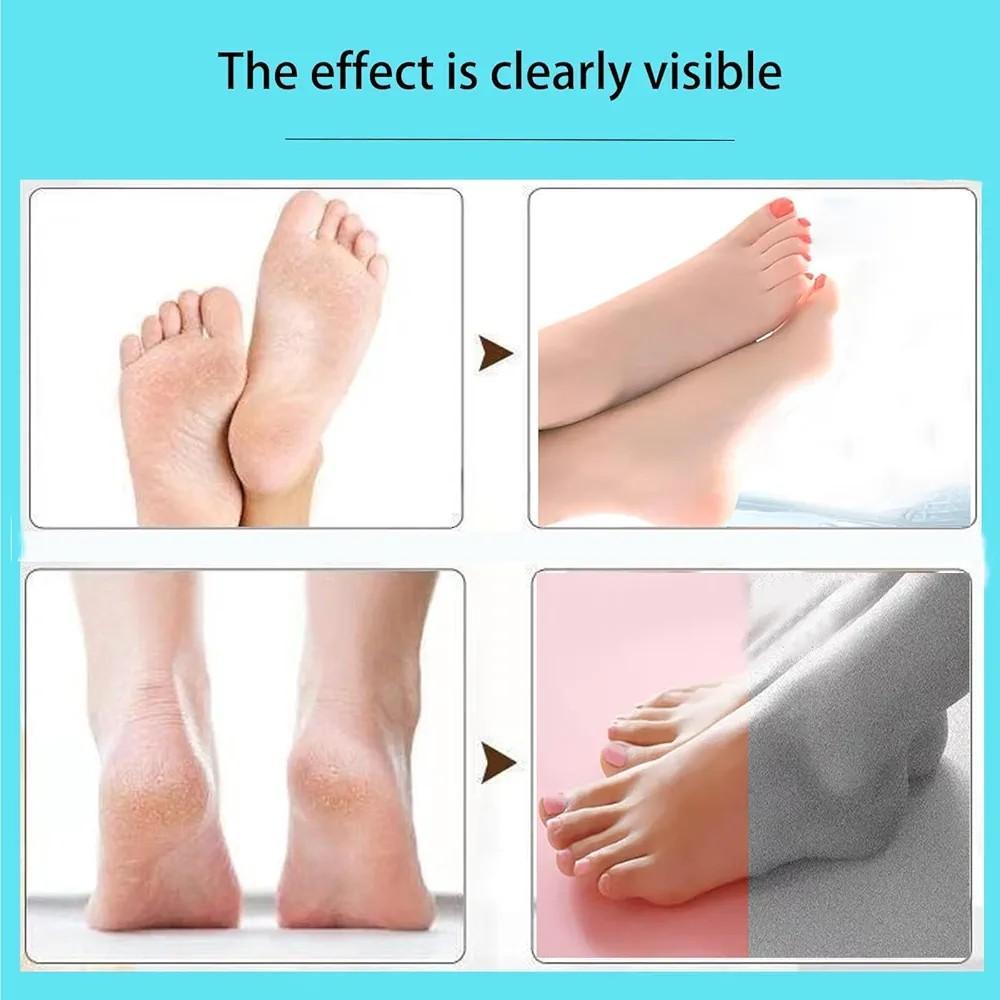 Electric Callus remover for dead skin removal -1 pc